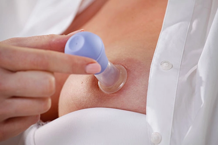 Modellatura delicata e rapida del capezzolo