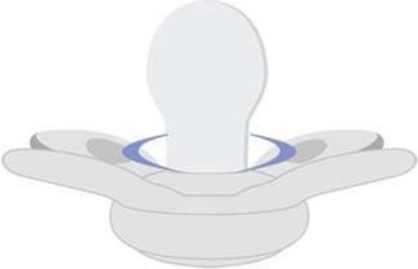 Tettarella ortodontica in silicone